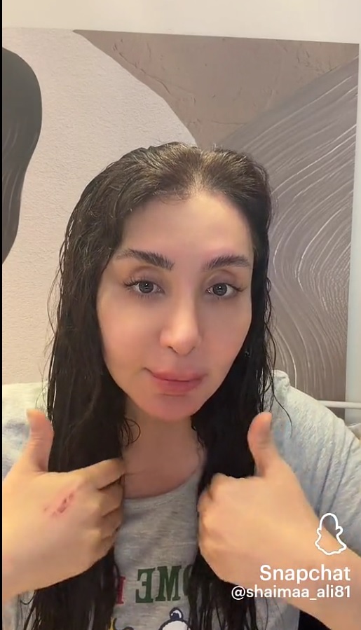 شيماء علي حادث  صورة السيارة المتضررة  دعاء شيماء على السلامة  تفاصيل حادث شيماء علي  نِجاة الفنانة شيماء علي  سلامة أولاد شيماء علي