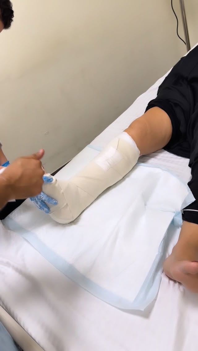 فيفي عبده - كسر ساق فيفي عبده - إصابة فيفي عبده - فيفي عبده في المستشفى - الحالة الصحية لفيفي عبده - نجوم يدعمون فيفي عبده - مي عز الدين - منة شلبي - نيللي كريم - صبا مبارك - ديانا كرزون