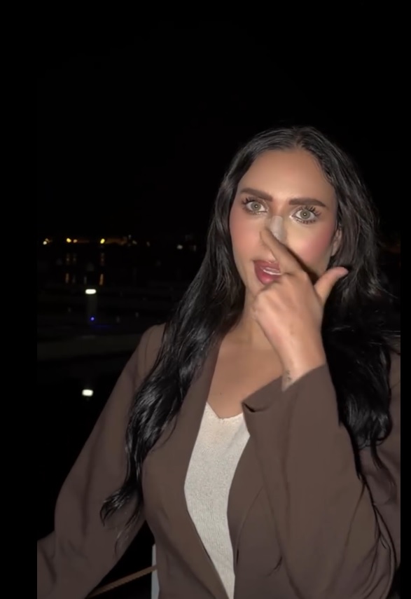 الدكتورة خلود - عملية تجميل الأنف - دكتورة خلود انستقرام - قبل وبعد تجميل الأنف - عمليات تجميل الخليج - محمد العيسى تجميل الأنف - مشاكل التنفس الأنف - تليفات والتصاقات الأنف