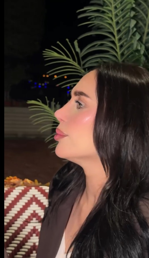 الدكتورة خلود - عملية تجميل الأنف - دكتورة خلود انستقرام - قبل وبعد تجميل الأنف - عمليات تجميل الخليج - محمد العيسى تجميل الأنف - مشاكل التنفس الأنف - تليفات والتصاقات الأنف