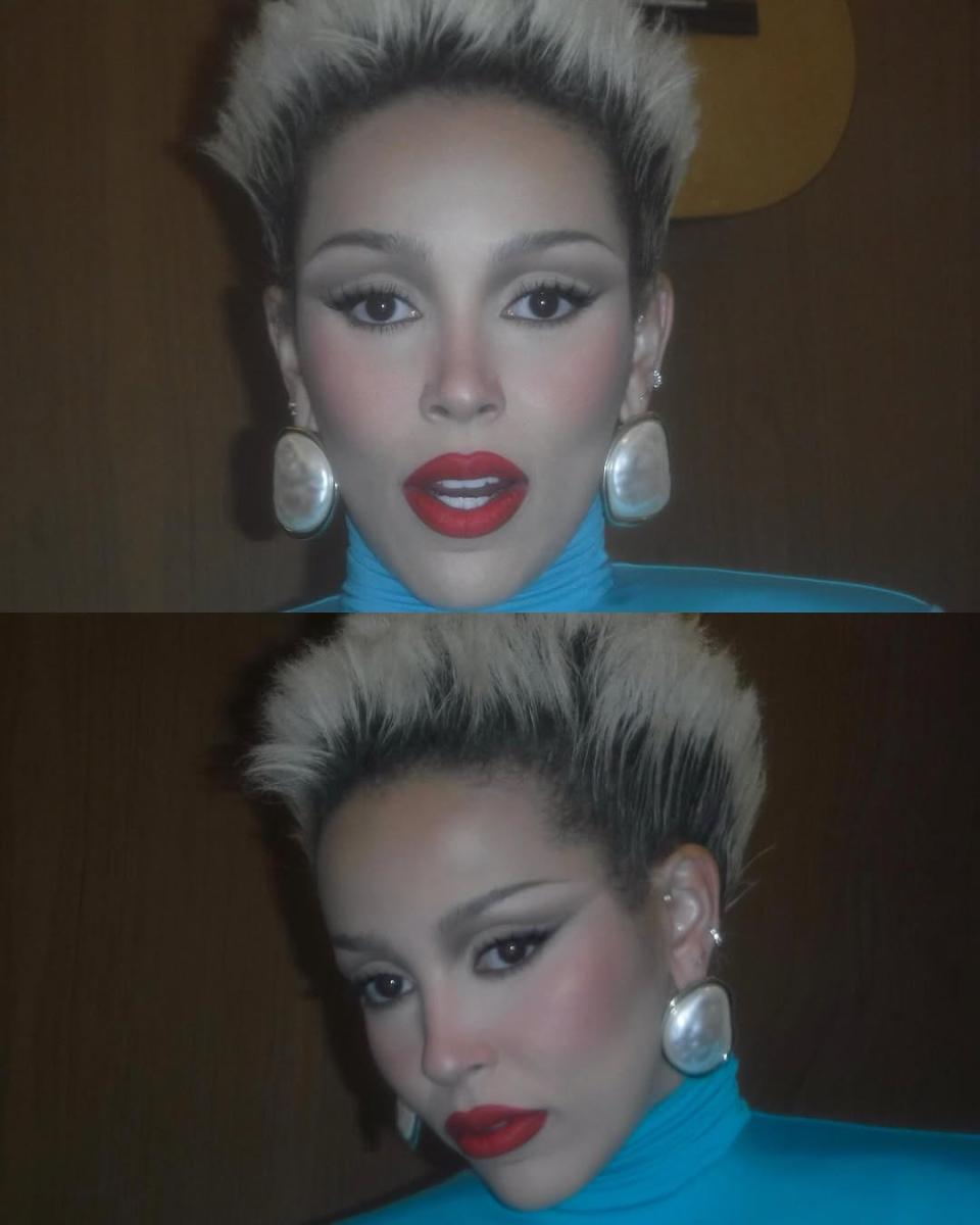 دوجا كات Doja Cat - اضطراب الشخصية الحدية BPD - Borderline Personality Disorder - دوجا كات الصحة النفسية - Doja Cat mental health - دوجا كات TikTok - تشابل روان Chappell Roan - Doja Cat BPD diagnosis - Doja Cat therapy - أخبار دوجا كات - نجوم هوليوود الصحة النفسية - Mayo Clinic Borderline Personality Disorder - Doja Cat Paint the Town Red - Doja Cat Say So - Doja Cat interview Angie Martinez IRL - Doja Cat paparazzi reaction - Chappell Roan paparazzi controversy - Doja Cat TikTok video March 2026