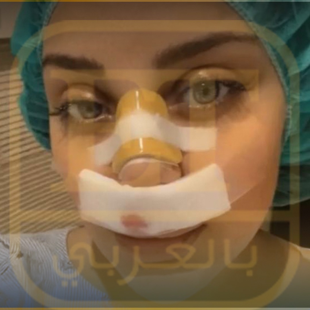 صور حصرية لزينب فياض بعد العملية التجميلية