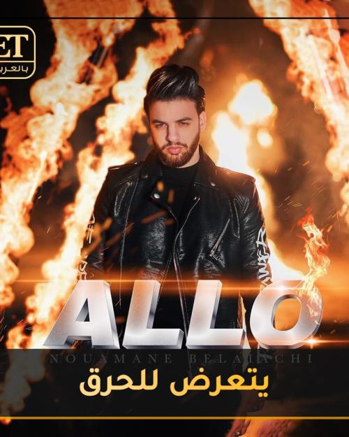 نعمان بلعياشي يتعرض للحرق