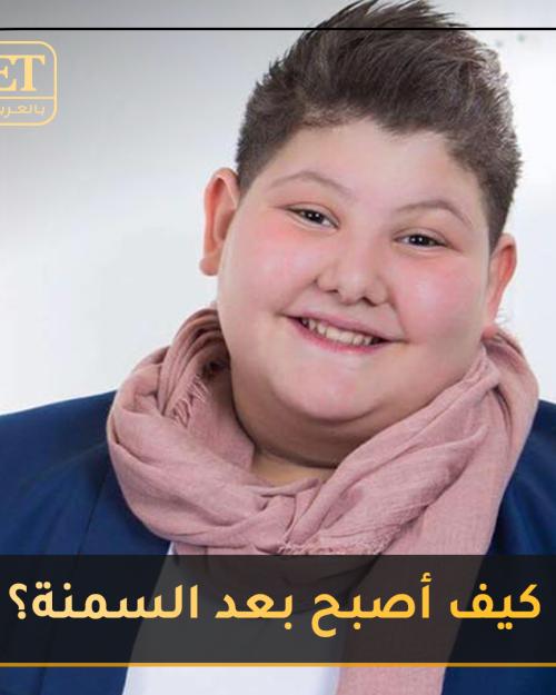 كيف أصبح زين عبيد بعد التخلص