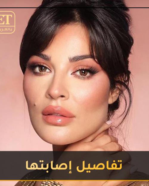 تفاصيل اصابة  نادين نجيم