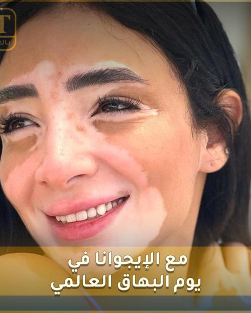 لجينة صلاح مع الإيغوانا