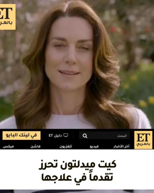 كيت ميدلتون تحرز تقدماً في علاجها