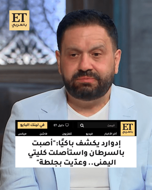 إدوارد - صورة معدلة