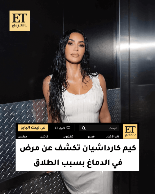 كيم كارداشيان تكشف عن مرض في الدماغ بسبب الطلاق