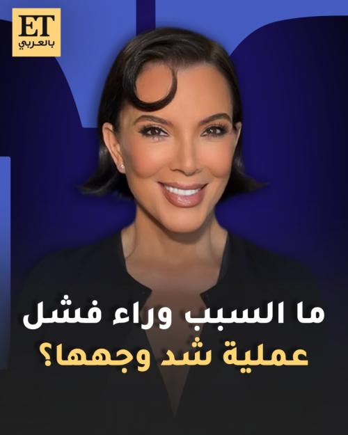 كريس جينر وعملية الـ Facelift