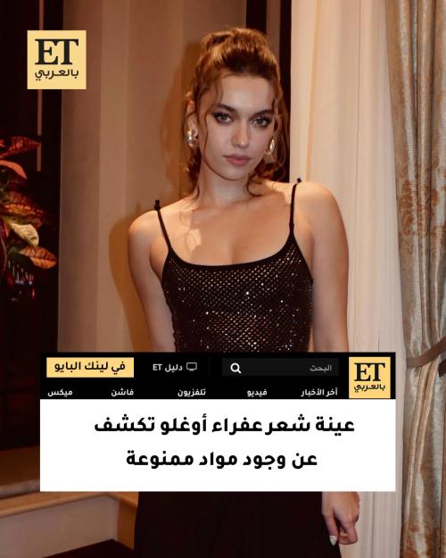 عينة شعر عفراء ساراتش أوغلو تكشف وجود مواد ممنوعة