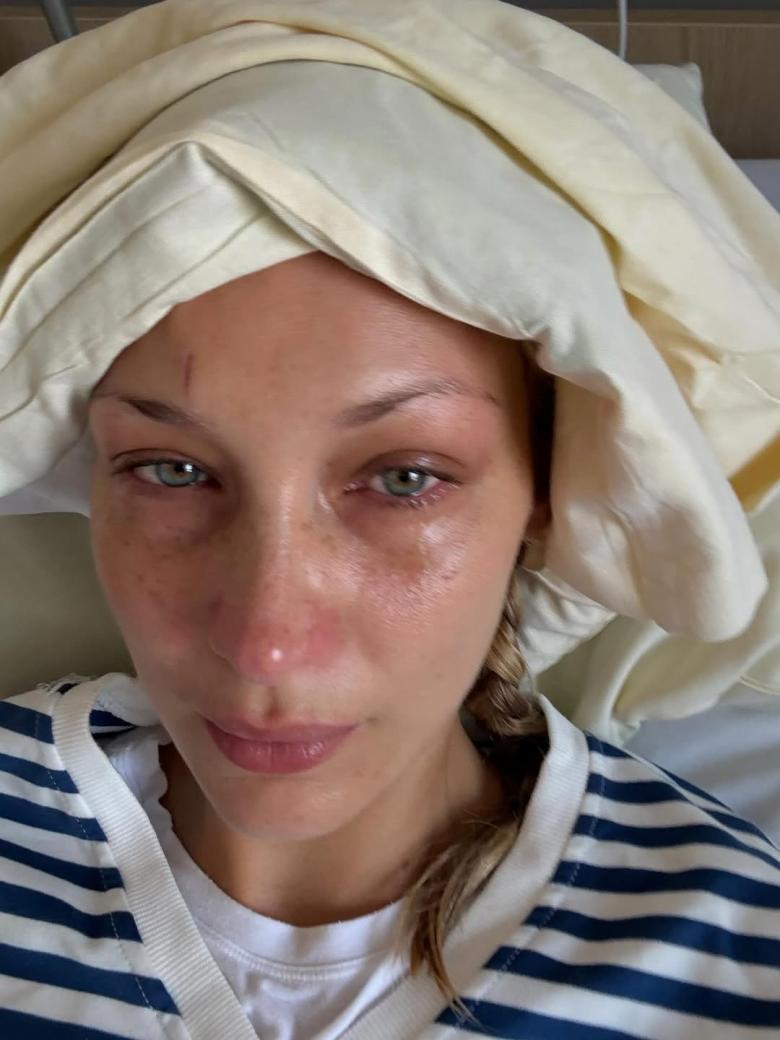بيلا حديد - Bella Hadid - مصدر من انستغرام