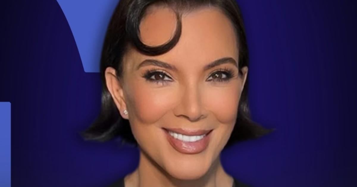 Doctor Explains Reasons Behind Kris Jenner's Facelift Outcome and Reveals Truth Behind Changes