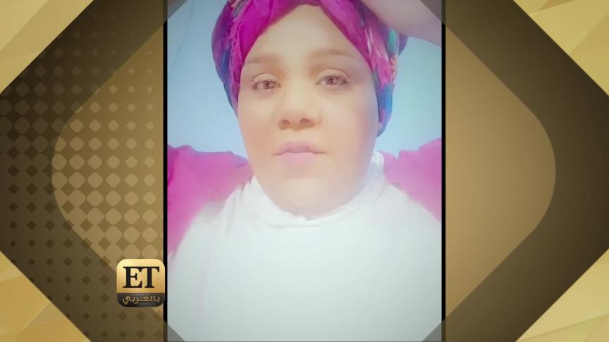 شيماء سيف لم تتقبّل صلعة زومبا