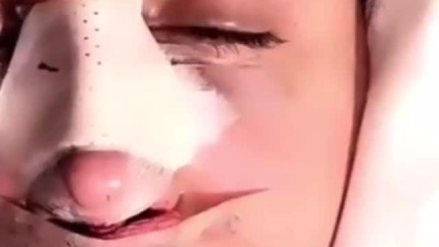 هند القحطاني بعد التجميل