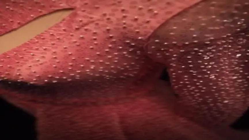 V