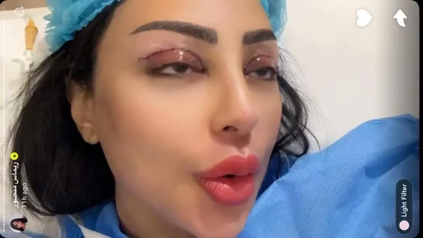 ريماس منصور تُجري عملية تجميل للعين