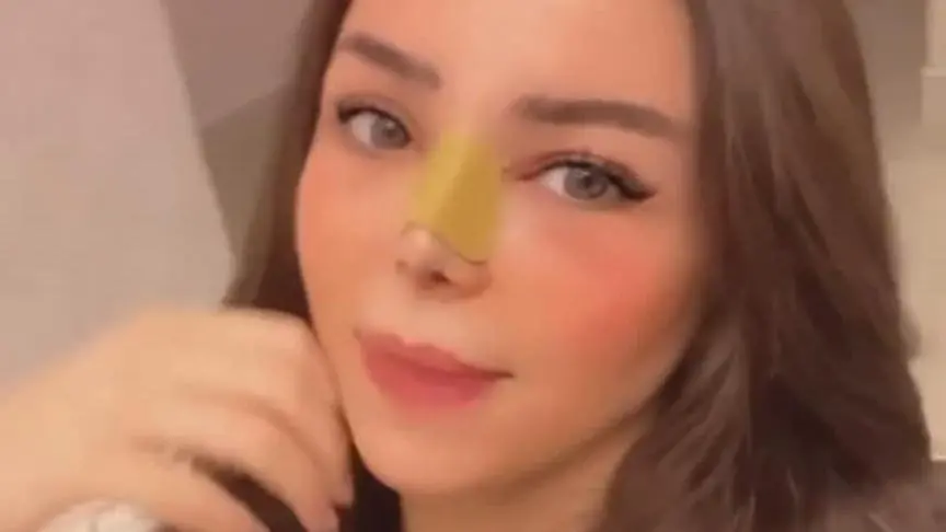 رهف القحطاني بعد التجميل
