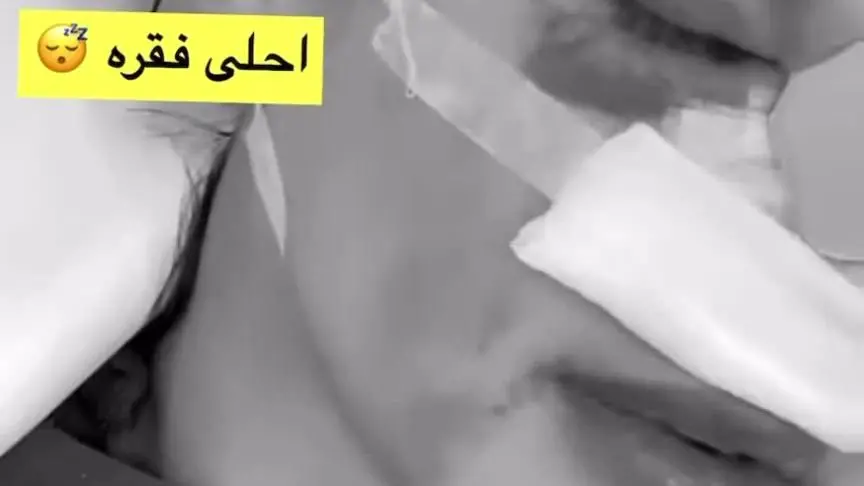 شوق الهادي بعد عملية التجميل
