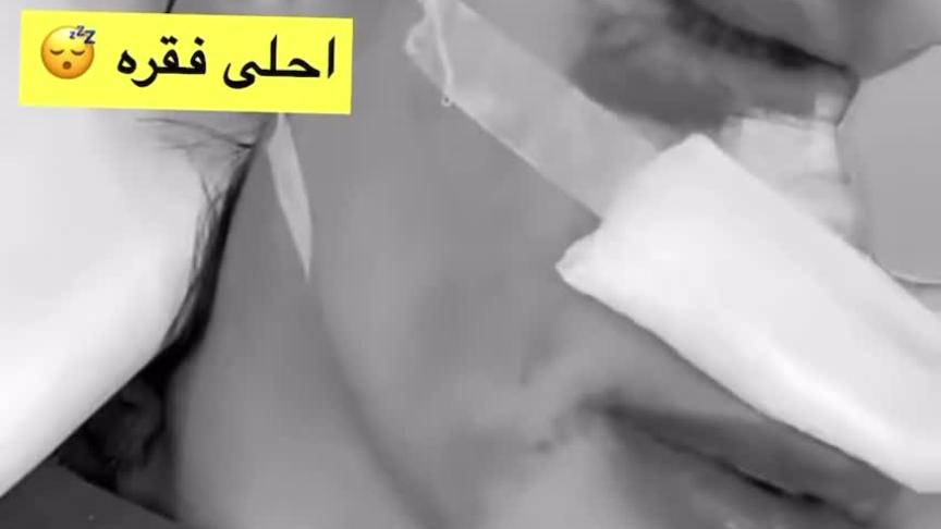 شوق الهادي بعد عملية التجميل