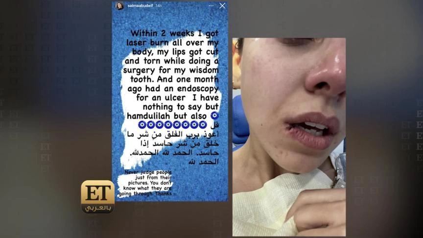 ETO03488 FINAL اصابات سلمى ابو ضيف