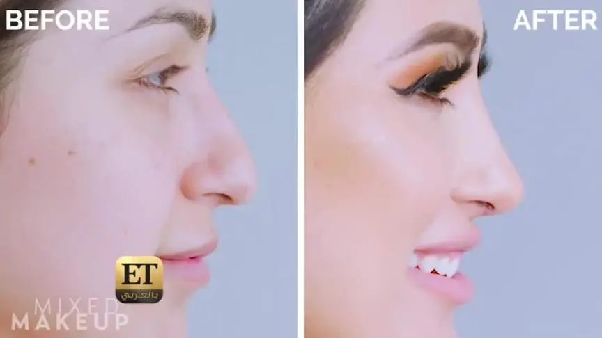 هل يغير COVID-19 شكل عمليات التجميل للأبد؟