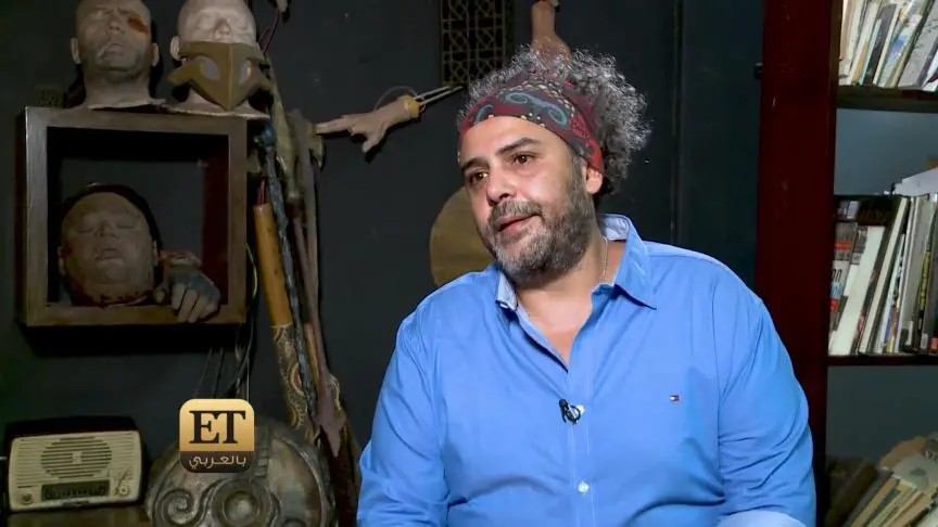 جميلة عوض مصابة بالبهاق 