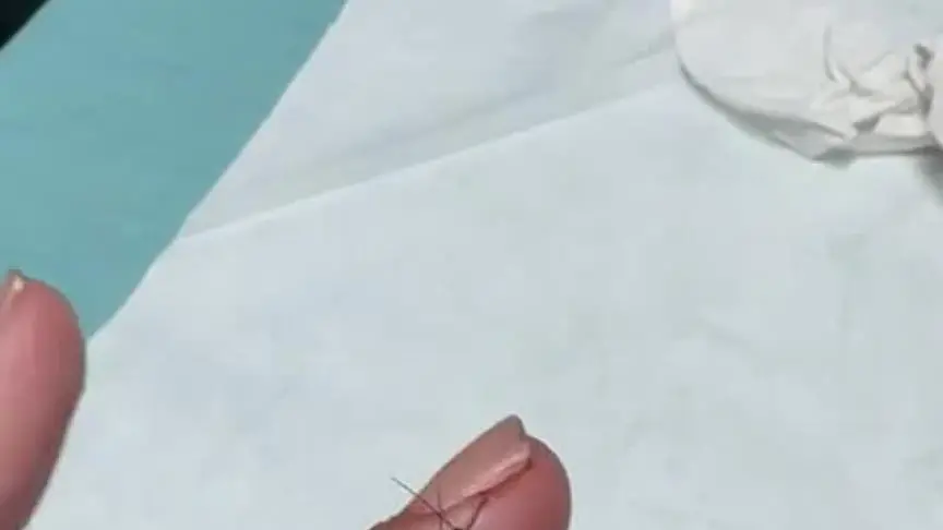 اصابة امل بوشوشة