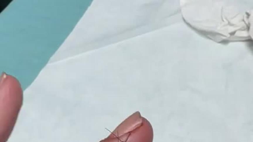 اصابة امل بوشوشة