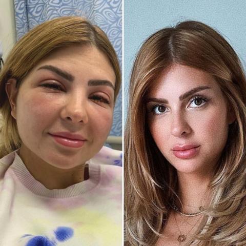 لينا قزيز تظهر بملامح وجه مختلفة &quot;غالباً ما منكون مهووسين أنو نصير أجمل&quot;