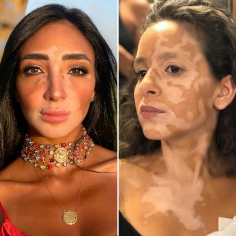 هل تكون لُجينة صلاح المرجع لشخصية جميلة عوض في &quot;لازم أعيش&quot;؟