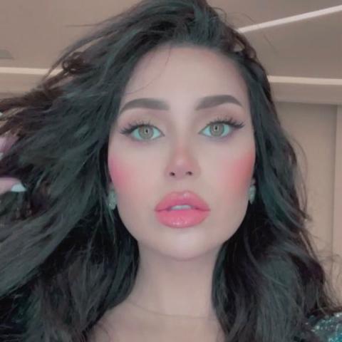 الدكتورة خلود بعد عملية التجميل