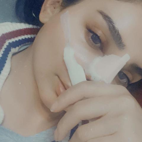 هيفاء حسوني تجري عملية ترميم لأنفها