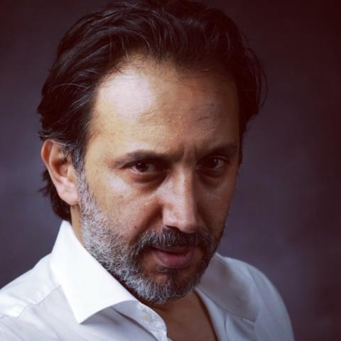 أحمد الأحمد يرد لأول مرة على جدل تجميل أنفه