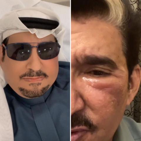 عبدالله السدحان -صورة معدلة من السوشيال ميديا