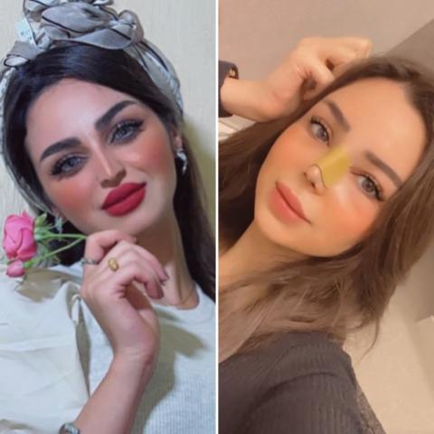 بعد ظهورها بملامح مختلفة.. رهف القحطاني &quot;أبي وجهي مرة باربي&quot;