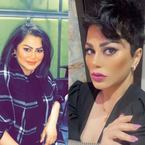 فاطمة الطباخ قبل وبعد التكميم- الصور من صفحتها على انستقرام
