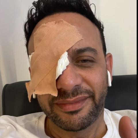 إصابة مصطفى قمر