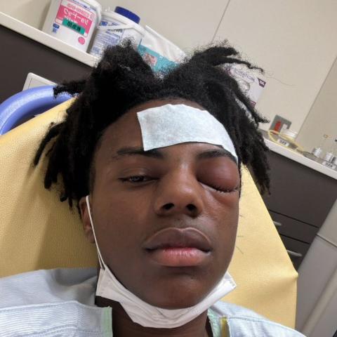 سبيد - صورة من تويتر