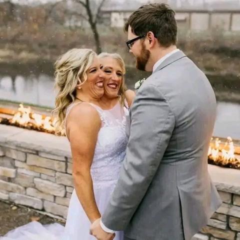 التوأم الملتصق - صورة من الزفاف