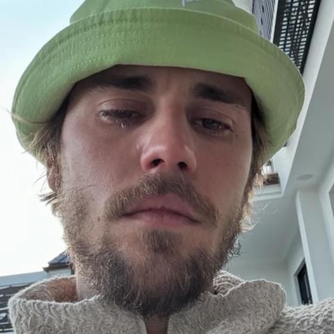 جاستن بيبر يثير قلق جمهوره على صحته بعد بوست إنستغرام