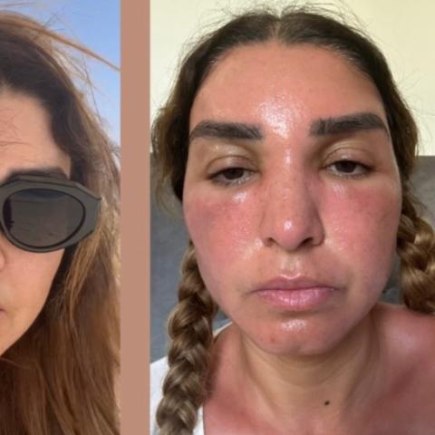 روجينا قبل و بعد تعرضها لأشعة الشمس - صورة معدلة