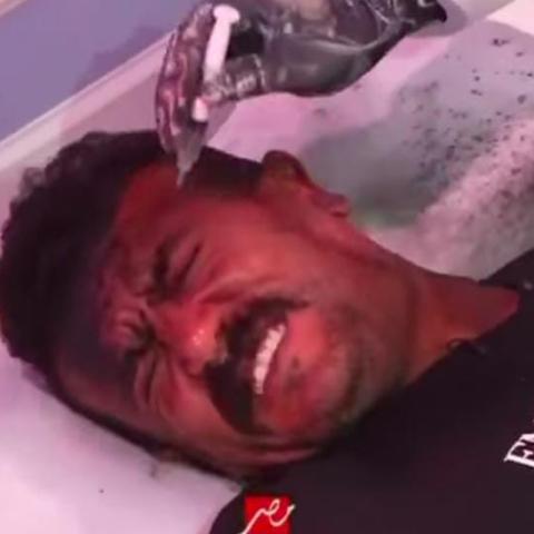 أحمد العوضي من برنامج رامز إيلون مصر